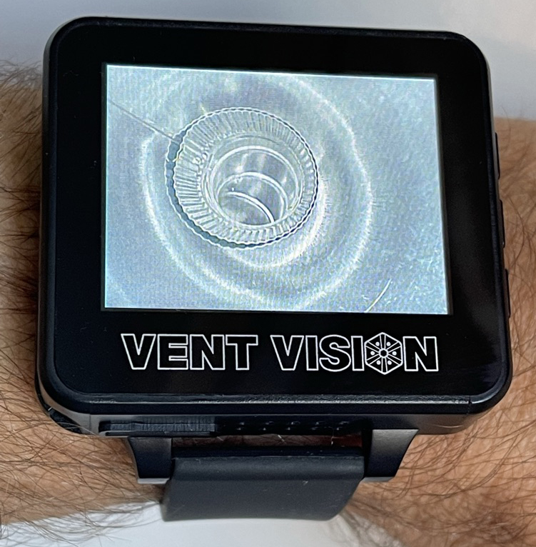VV1W Vent Vision Watch monitor